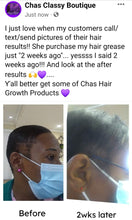 Load image into Gallery viewer, Chas Hair Growth Oil
